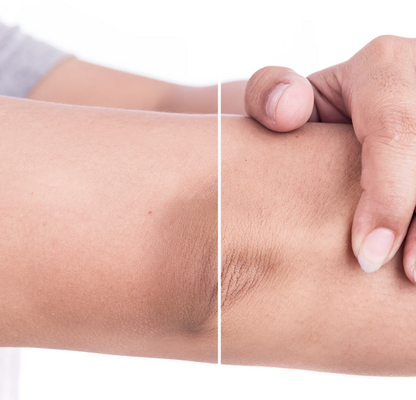 Skin Glo Exfolia Stanhome